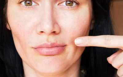 Pimples on the Lip: How to get rid of them quickly