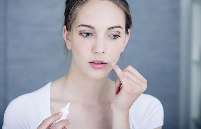 Woman-applying-medicine-to-the-lip-pimple