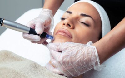 What Is Microneedling? The Role of Microneedling